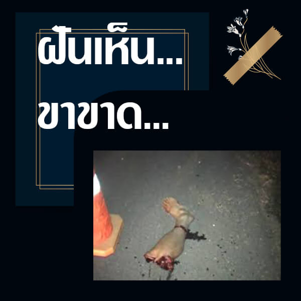 ทำนายฝันเห็นขาขาด